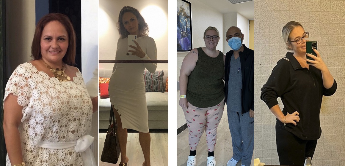 Cirugía Bariátrica en México │Dr Sergio del Hoyo