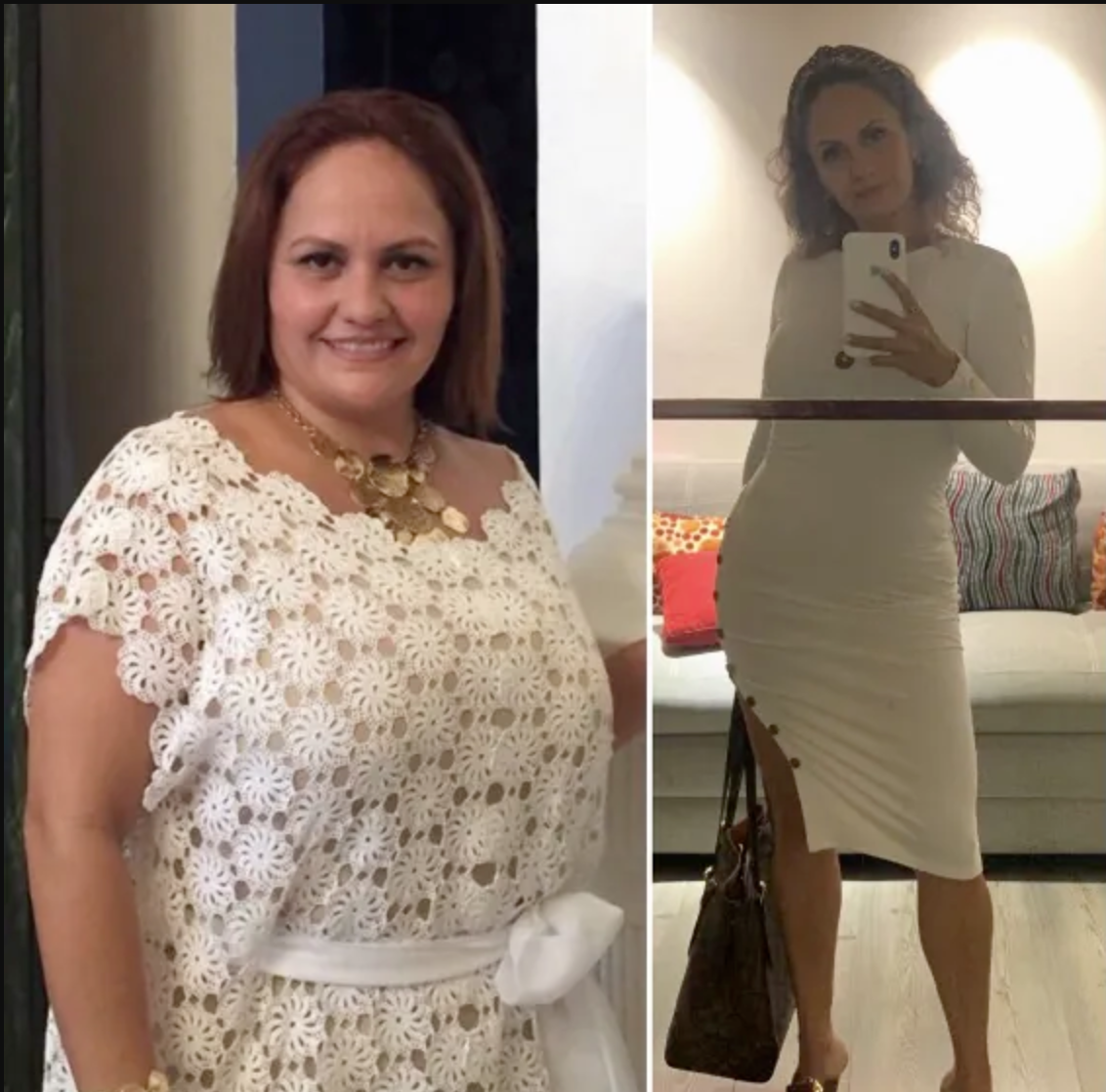 gastric-surgery-before-after.png