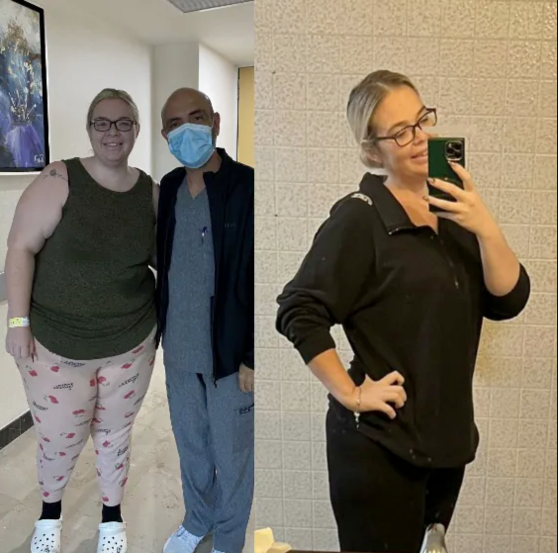 gastric-surgery-results.png